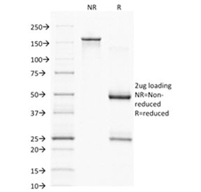 SDS-PAGE analysis of purified, BSA-free CD68 antibody (clone C68/2501) as confirmation of integrity and purity.