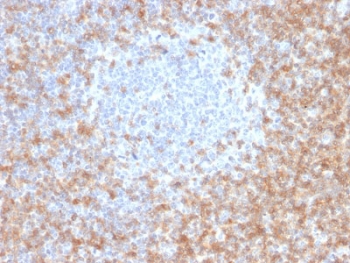 CD5 Antibody Clone CD5/2416. Immunohistochemistry analysis of CD5 antibody staining in FFPE human tonsil tissue using a protein microarray validated antibody. Strong membranous staining is observed in T lymphocytes within interfollicular regions, with dense labeling surrounding germinal centers while follicular B cell areas remain relatively negative. The staining pattern highlights normal tonsillar architecture and supports specific detection of CD5-positive T cell populations, consistent with validation-backed target recognition. Heat-induced epitope retrieval was performed in 10 mM citrate buffer, pH 6, for 10-20 minutes followed by cooling at room temperature prior to antibody incubation.