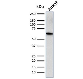 CD5 Antibody Clone CD5/2416. Western blot analysis of CD5 antibody in human Jurkat cell lysate using a protein microarray validated antibody. A band is detected at approximately 55-67 kDa, consistent with the predicted molecular weight of CD5, with size variation reflecting known glycosylation of this membrane glycoprotein. The strong signal observed in this T cell-derived lysate aligns with the established enrichment of CD5 in T lymphocytes and supports specificity consistent with protein microarray validation.