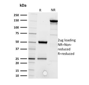 SDS-PAGE analysis of purified, BSA-free CD5 antibody (clone CD5/2416) as confirmation of integrity and purity.
