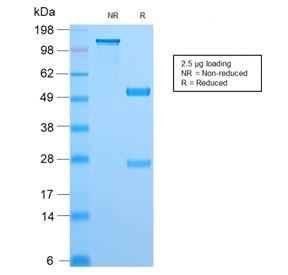 SDS-PAGE analysis of purified, BSA-free recombinant TOP1MT antibody (clone TOP1MT/2883R) as confirmation of integrity and purity.