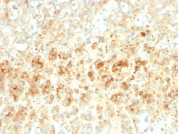 Adipophilin Antibody FFPE Adrenal Tissue IHC. Immunohistochemistry staining of FFPE human adrenal tissue with recombinant Adipophilin antibody (clone ADFP/2755R). Required HIER: steam sections in pH6, 10mM citrate buffer for 10-20 min.