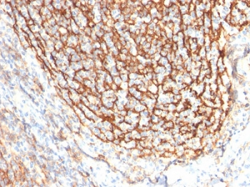 CD21 Antibody Tonsil IHC. Immunohistochemistry of Complement Receptor 2 / CD21 in FFPE human tonsil tissue using mouse monoclonal CD21 antibody, clone CR2/2754. HRP-DAB brown staining highlights a dense reticular follicular dendritic cell network within germinal centers, with accompanying membranous staining of B lymphocytes, consistent with CD21 localization in B-cell-rich regions, while nuclei are counterstained blue. Heat induced epitope retrieval was performed by boiling tissue sections in pH 6 10 mM citrate buffer for 10-20 min followed by cooling at RT prior to staining.