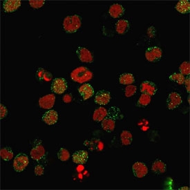 CD21 Antibody MOLT4 IF. Immunofluorescence analysis of Complement Receptor 2 / CD21 in PFA-fixed human MOLT4 cells using mouse monoclonal CD21 antibody, clone CR2/2754. Green fluorescence highlights CD21-positive cell surface and cytoplasmic signal, while nuclei are counterstained with Reddot (red).