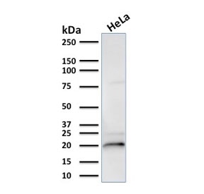 Western blot testing of human HeLa lysate with CRYAB antibody (clone CPTC-CRYAB-1). Predicted molecular weight: ~20 kDa.