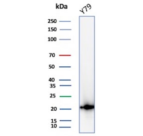 CRYAB Antibody Y79 Cell WB. Western blot testing of human Y79 cell lysate with CRYAB antibody (clone CPTC-CRYAB-1). Predicted molecular weight: ~20 kDa.