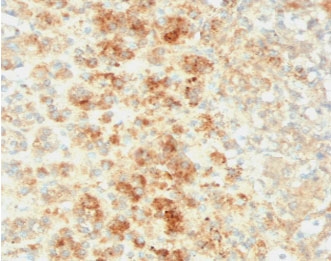 IHC testing of FFPE human adrenal tissue with recombinant Perilipin 2 antibody (clone ADPN1-2R). Required HIER: steam sections in pH6, 10mM citrate buffer for 10-20 min.