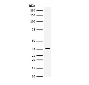AKR1B1 Antibody HeLa WB. Western blot testing of human HeLa cell lysate with AKR1B1 antibody (clone ADRD1-1). Predicted molecular weight ~36 kDa.