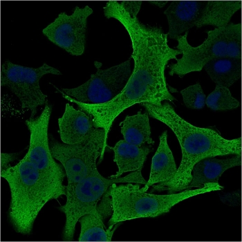 AKR1B1 Antibody A549 IF. Immunofluorescence analysis of human A549 cells stained with AKR1B1 Antibody clone CPTC-AKR1B1-2 (green) and DAPI nuclear counterstain (blue). Strong cytoplasmic fluorescence is observed throughout A549 cells, consistent with the expected intracellular localization of Aldose reductase / AKR1B1, an oxidative stress-associated metabolic enzyme involved in reactive aldehyde detoxification, glucose-responsive signaling, and cellular redox regulatory pathways.