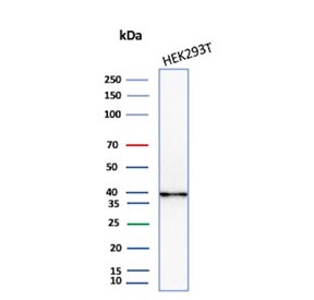 AKR1B1 Antibody HEK293 WB. Western blot analysis of human HEK293 cell lysate using AKR1B1 Antibody clone CPTC-AKR1B1-2. A strong band is detected near approximately 35-40 kDa, consistent with the predicted molecular weight of Aldose reductase / AKR1B1, an oxidative stress-associated aldo-keto reductase family enzyme involved in reactive aldehyde detoxification, glucose-responsive signaling, and cellular redox regulatory pathways.