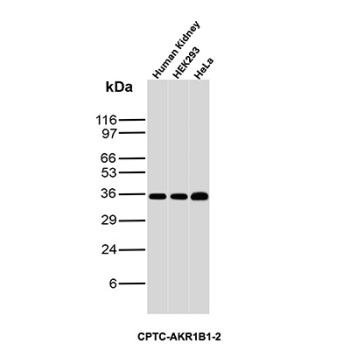 AKR1B1 Antibody Tissue and Cell Line WB. Western blot analysis of human kidney tissue together with HEK293 and HeLa cell lysates using AKR1B1 Antibody clone CPTC-AKR1B1-2. Strong bands are detected near approximately 35-40 kDa across all samples, consistent with the predicted molecular weight of Aldose reductase / AKR1B1, an oxidative stress-associated aldo-keto reductase family enzyme involved in reactive aldehyde detoxification, glucose-responsive signaling, and cellular redox regulatory pathways.