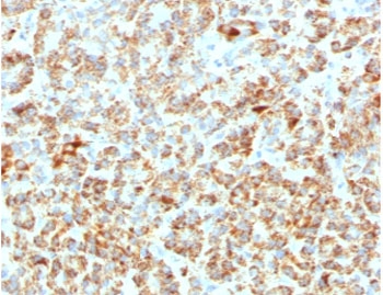 Frataxin Antibody Pancreatic Mitochondrial IHC. Immunohistochemistry staining of FFPE human pancreas tissue using monoclonal clone FDAX-1 demonstrates widespread granular cytoplasmic HRP-DAB brown staining within pancreatic epithelial and acinar-associated cellular populations, consistent with mitochondrial localization of Frataxin / FXN in metabolically active tissue compartments. The observed staining pattern supports the established role of FXN in mitochondrial iron regulation and oxidative phosphorylation-associated energy metabolism. Required HIER: boil tissue sections in pH 9 10mM Tris with 1mM EDTA for 10-20 min and allow to cool before testing.