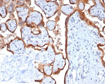 HCG-beta Antibody Human Placenta IHC. Immunohistochemistry staining of FFPE human placental tissue with HCG-beta antibody (clone HCGb/7201R). Negative control inset: PBS used instead of primary antibody to control for secondary Ab binding.