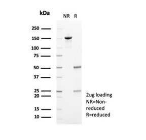 SDS-PAGE analysis of purified, BSA-free Fibrillin-1 antibody (clone FBN1/6933) as confirmation of integrity and purity.