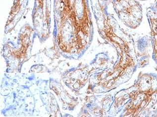 Decorin Antibody Human Placenta IHC. Immunohistochemistry of Decorin antibody in human placental tissue. Formalin-fixed, paraffin-embedded human placenta was stained using Decorin antibody (clone DCN/6289) at 2 ug/ml. Brown HRP-DAB chromogenic signal highlights extracellular stromal regions and perivascular connective tissue consistent with Decorin localization within the placental matrix. The inset negative control shows PBS used in place of primary antibody to assess non-specific secondary antibody binding, demonstrating absence of background staining.