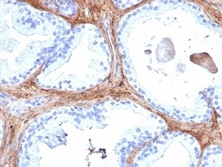 Decorin Antibody Human Prostate Tissue IHC. Immunohistochemistry of Decorin antibody in human prostate tissue. Formalin-fixed, paraffin-embedded human prostate was stained using Decorin antibody (clone DCN/6289). Heat induced epitope retrieval was performed by boiling tissue sections in 10mM Tris with 1mM EDTA, pH 9, for 20 min followed by cooling prior to staining. HRP-DAB brown chromogenic signal highlights extracellular stromal connective tissue surrounding prostatic glands, consistent with Decorin localization within the collagen-rich matrix.