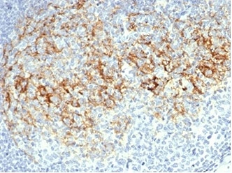 CD23 Antibody Follicular Dendritic Cell IHC. Immunohistochemistry staining of FFPE human lymph node tissue with CD23 antibody (clone FCER2/6888). HIER: boil tissue sections in pH 9 10mM Tris with 1mM EDTA for 20 min and allow to cool before testing.