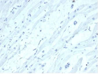 Negative control: IHC staining of FFPE human heart tissue with SATB2 antibody (clone SATB2/7111). HIER: boil tissue sections in pH 9 10mM Tris with 1mM EDTA for 20 min and allow to cool before testing.