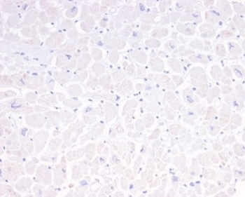 Negative control: IHC analysis of FFPE human heart tissue using GFAP antibody (clone GFAP/6880). HIER: boil tissue sections in pH 9 10mM Tris with 1mM EDTA for 20 min and allow to cool before testing.