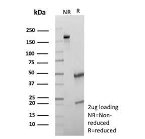 SDS-PAGE analysis of purified, BSA-free GFAP antibody (clone GFAP/6880) as confirmation of integrity and purity.