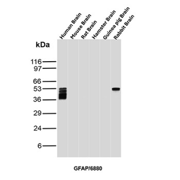 GFAP Antibody Brain Tissue WB. Western blot analysis of human brain, mouse brain, rat brain, hamster brain, guinea pig brain, and rabbit brain tissue lysates using GFAP Antibody clone GFAP/6880. Distinct bands are detected at approximately 50 kDa in human and rabbit brain lysates, consistent with the predicted molecular weight of Glial fibrillary acidic protein / GFAP, a major astrocytic intermediate filament protein involved in maintenance of neural cytoskeletal architecture. Multiple closely migrating lower molecular weight bands observed in the human brain sample likely represent GFAP isoforms and/or partial proteolytic processing products commonly encountered in brain tissue lysates.