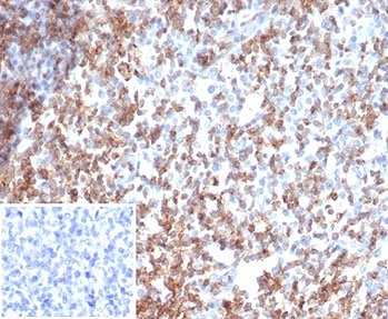 IHC staining of FFPE human tonsil tissue with recombinant CD2 antibody (clone rLFA2/7147). Negative control inset: PBS used instead of primary antibody to control for secondary Ab binding. HIER: boil tissue sections in pH 9 10mM Tris with 1mM EDTA for 20 min and allow to cool before testing.