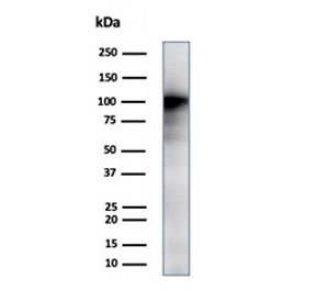 Western blot testing of human kidney tissue lysate using CD13 antibody (clone APN/6998). Expected molecular weight: 110-150 kDa depending on glycosylation level.