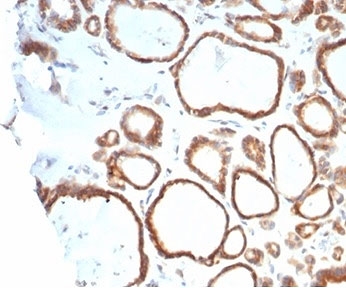 HSP90 beta Antibody Thyroid IHC. Immunohistochemistry staining of FFPE human thyroid tissue with HSP90AB1 antibody (clone HSP90AB1/4970). HIER: boil tissue sections in pH 9 10mM Tris with 1mM EDTA for 20 min and allow to cool before testing.