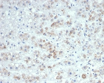 Interleukin-6 Antibody Human Adrenal Gland IHC. Immunohistochemical staining of FFPE human adrenal gland tissue using Interleukin-6 Antibody / IL6 Antibody (clone IL6/4647) demonstrates granular cytoplasmic HRP-DAB brown staining within scattered adrenal cortical cells. The observed staining pattern is consistent with expression of IL6, a multifunctional cytokine involved in inflammatory signaling, immune regulation, stress responses, and communication between endocrine and immune systems. Detection of IL6 within adrenal tissue supports the utility of this antibody for investigating cytokine-mediated signaling pathways and inflammatory mechanisms across endocrine and immune-related research applications. HIER: boil tissue sections in pH 9 10mM Tris with 1mM EDTA for 20 min and allow to cool before testing.