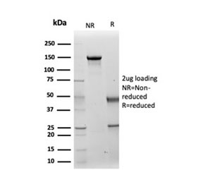 SDS-PAGE analysis of purified, BSA-free Cytokeratin 14 antibody (clone KRT14/4131) as confirmation of integrity and purity.