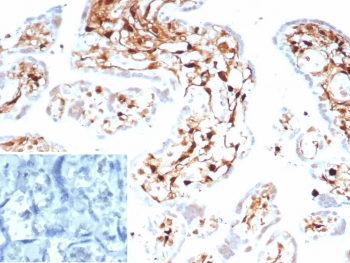 IHC staining of FFPE human placental tissue with S100A4 antibody (clone S100A4/7096). Inset: PBS used in place of primary Ab (secondary Ab negative control). HIER: boil tissue sections in pH 9 10mM Tris with 1mM EDTA for 20 min and allow to cool before testing.
