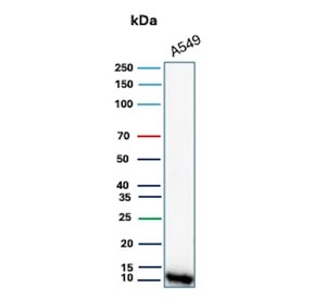 Western blot testing of human A549 cell lysate with S100A4 antibody. Predicted molecular weight ~12 kDa.