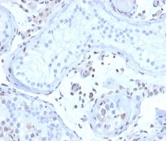 IHC staining of FFPE human testis tissue with MGMT antibody (clone MGMT/4791). HIER: boil tissue sections in pH 9 10mM Tris with 1mM EDTA for 20 min and allow to cool before testing.