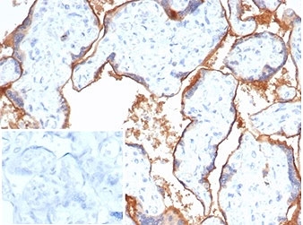 Immunohistochemistry analysis of PVRL4 / Nectin-4 antibody (clone NECT4/7271) in human placental tissue. Formalin-fixed, paraffin-embedded placenta demonstrates prominent membranous HRP-DAB brown staining outlining trophoblastic cells and chorionic villi, consistent with cell surface localization of PVRL4. Background staining is minimal, and nuclear counterstain highlights tissue architecture. The inset shows PBS used in place of primary antibody as a negative control, confirming absence of non-specific secondary antibody binding. Heat-induced epitope retrieval was performed by boiling tissue sections in pH 9 10 mM Tris with 1 mM EDTA for 20 minutes followed by cooling prior to staining.