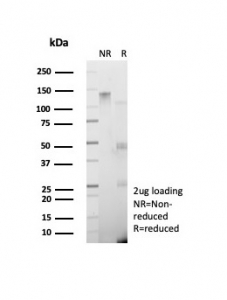 SDS-PAGE analysis of purified, BSA-free recombinant GAD2 antibody (clone GAD2/8547) as confirmation of integrity and purity.