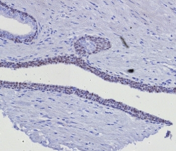 GATA-3 Antibody Prostate Tissue IHC. Immunohistochemistry staining of FFPE human prostate tissue with GATA-3 antibody (clone GATA3/8327R). HIER: boil tissue sections in pH 9 10mM Tris with 1mM EDTA for 20 min and allow to cool before testing.