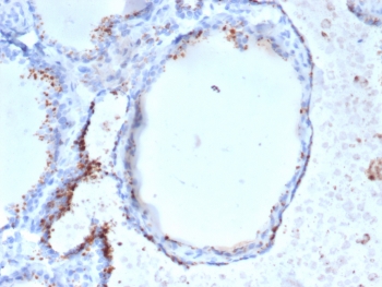 GAD65 Antibody Thyroid IHC. Immunohistochemistry staining of FFPE human thyroid tissue with GAD2 (GAD65) antibody (clone GAD2/6484). HIER: boil tissue sections in pH 9 10mM Tris with 1mM EDTA for 20 min and allow to cool before testing.