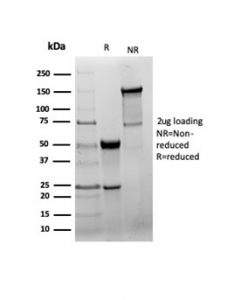 SDS-PAGE analysis of purified, BSA-free GAD65 antibody recombinant rabbit mAb GAD2/6488R as confirmation of integrity and purity.