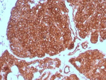 Immunohistochemistry analysis of c-RET / Receptor Tyrosine Kinase RET antibody (clone RET/7690) in human parathyroid gland. FFPE human parathyroid tissue shows strong membranous and cytoplasmic HRP-DAB brown staining in parathyroid epithelial cells, consistent with RET expression. Staining is diffuse across the glandular cell population with prominent membrane accentuation, while stromal components demonstrate comparatively weaker signal. Nuclei are counterstained blue. Heat induced epitope retrieval was performed by boiling tissue sections in 10 mM Tris with 1 mM EDTA, pH 9.0, for 20 minutes followed by cooling prior to immunostaining.