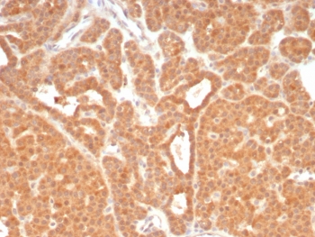 Immunohistochemistry analysis of c-RET / RET Tyrosine Kinase Receptor antibody (clone RET/8789) in human parathyroid tissue. FFPE human parathyroid demonstrates diffuse membranous and cytoplasmic HRP-DAB brown staining in parathyroid epithelial cells, consistent with RET expression. Staining is strong and relatively uniform across the glandular cell population, with clear membrane accentuation outlining individual cells. Stromal elements show comparatively weaker signal. Nuclei are counterstained blue. Heat induced epitope retrieval was performed by boiling tissue sections in 10 mM Tris with 1 mM EDTA, pH 9.0, for 20 minutes followed by cooling prior to immunostaining.
