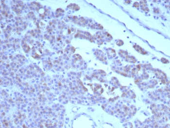 IHC staining of FFPE human parathyroid tissue with c-RET antibody (clone RET/8791). HIER: boil tissue sections in pH 9 10mM Tris with 1mM EDTA for 20 min and allow to cool before testing.
