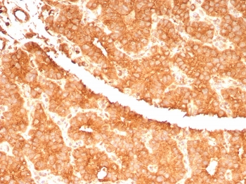Immunohistochemistry analysis of c-RET / MEN2-Associated RET Protein antibody (clone RET/7694) in human parathyroid gland tissue. FFPE human parathyroid demonstrates strong membranous and cytoplasmic HRP-DAB brown staining in parathyroid epithelial cells, consistent with RET expression. Staining is diffuse and uniform across the glandular cell population with clear membrane accentuation outlining individual cells, while surrounding stromal components show comparatively weaker signal. Nuclei are counterstained blue. Heat induced epitope retrieval was performed by boiling tissue sections in 10 mM Tris with 1 mM EDTA, pH 9.0, for 20 minutes followed by cooling prior to immunostaining.