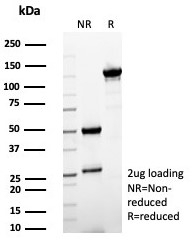 SDS-PAGE analysis of purified, BSA-free SFTPD antibody (clone rSFTPD/8065) as confirmation of integrity and purity.