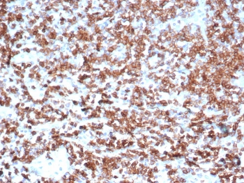 IHC analysis of CD39 Antibody in FFPE human tonsil tissue. The antibody for IHC (clone CD39/6860) demonstrates membranous HRP-DAB brown staining in lymphocytes within germinal centers and interfollicular regions, consistent with ENTPD1 / CD39 expression. Heat-induced epitope retrieval was performed in 10mM Tris with 1mM EDTA, pH 9.0, at 95oC for 20 minutes followed by cooling before testing.