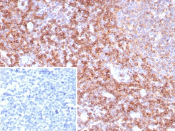 IHC staining of FFPE human tonsil tissue with CD39 antibody (clone CD39/8538R). Inset: PBS used in place of primary Ab (secondary Ab negative control). HIER: boil tissue sections in pH 9 10mM Tris with 1mM EDTA for 20 min and allow to cool before testing.