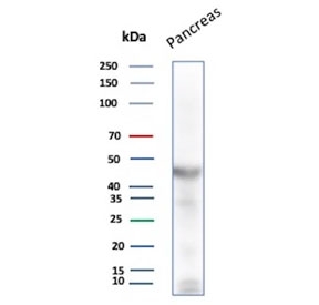 Western blot testing of human pancreas tissue lysate with Pancreatic lipase antibody (clone PNLIP/8916). Predicted molecular weight ~51 kDa.