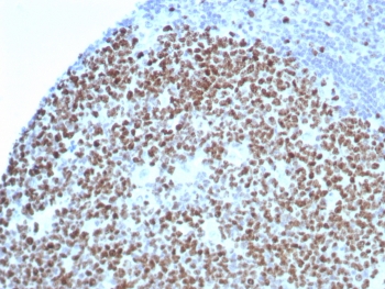 Ki-67 Antibody Recombinant Mouse MAb rMKI67/8852. Immunohistochemistry analysis of FFPE human tonsil tissue using Ki-67 antibody recombinant mouse mAb (clone rMKI67/8852). Strong nuclear brown staining is observed in numerous proliferating lymphoid cells within the tonsillar germinal center, consistent with the known expression pattern of Ki-67 / MKI67 in actively dividing cells. Non-proliferating surrounding lymphoid and stromal cells show minimal staining. Heat-induced epitope retrieval was performed by boiling tissue sections in pH 9 10mM Tris with 1mM EDTA for 20 minutes followed by cooling prior to staining.