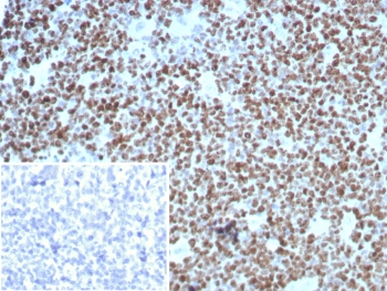 Ki-67 Antibody Recombinant Mouse MAb rMKI67/8852. Immunohistochemistry analysis of FFPE human tonsil tissue using Ki-67 antibody recombinant mouse mAb (clone rMKI67/8852). Strong nuclear brown staining is observed in numerous proliferating lymphoid cells within the tonsillar germinal center, consistent with the known expression pattern of Ki-67 / MKI67 in actively dividing cells. Surrounding lymphoid and stromal cells show minimal staining. Inset: PBS was used in place of the primary antibody as a secondary antibody negative control. Heat-induced epitope retrieval was performed by boiling tissue sections in pH 9 10mM Tris with 1mM EDTA for 20 minutes followed by cooling prior to staining.