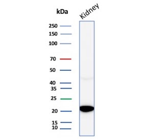 CRYAB Antibody Muscle Stress WB. Western blot analysis of Alpha B crystallin / CRYAB in human kidney tissue lysate using mouse monoclonal CRYAB antibody, clone CRYAB/4663. A band is detected at approximately 20 kDa, consistent with the predicted molecular weight of CRYAB, supporting detection of this small heat shock protein involved in cytoskeletal stabilization and structural stress response.