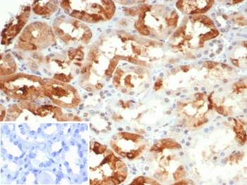 CRYAB Antibody Renal Epithelium IHC. Immunohistochemistry of Alpha B crystallin / CRYAB in FFPE human kidney tissue using mouse monoclonal CRYAB antibody, clone CRYAB/4665. HRP-DAB brown staining highlights cytoplasmic labeling of renal tubular epithelial cells, consistent with molecular chaperone function and protein stability within metabolically active tissue, while surrounding interstitial cells show minimal staining and nuclei are counterstained blue. Inset: PBS was used in place of primary antibody as a negative control to confirm specificity of staining. Heat induced epitope retrieval was performed by boiling tissue sections in pH 9 10 mM Tris with 1 mM EDTA for 20 min followed by cooling prior to staining.